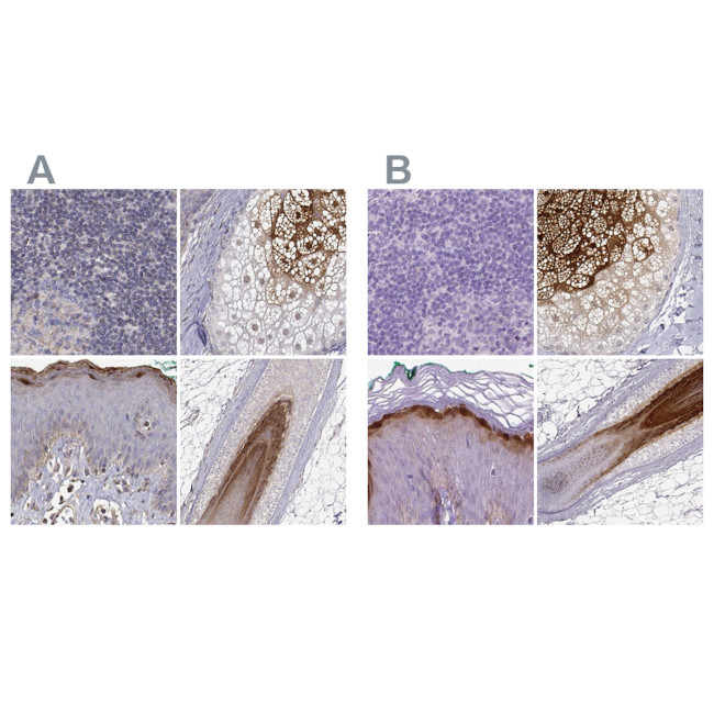 GSDMA Antibody in Immunohistochemistry (IHC)