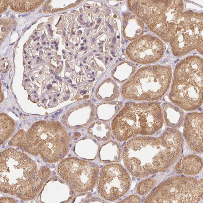 REV3L Antibody in Immunohistochemistry (Paraffin) (IHC (P))