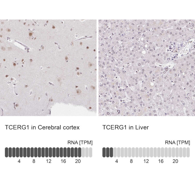 CA150 Antibody in Immunohistochemistry (IHC)