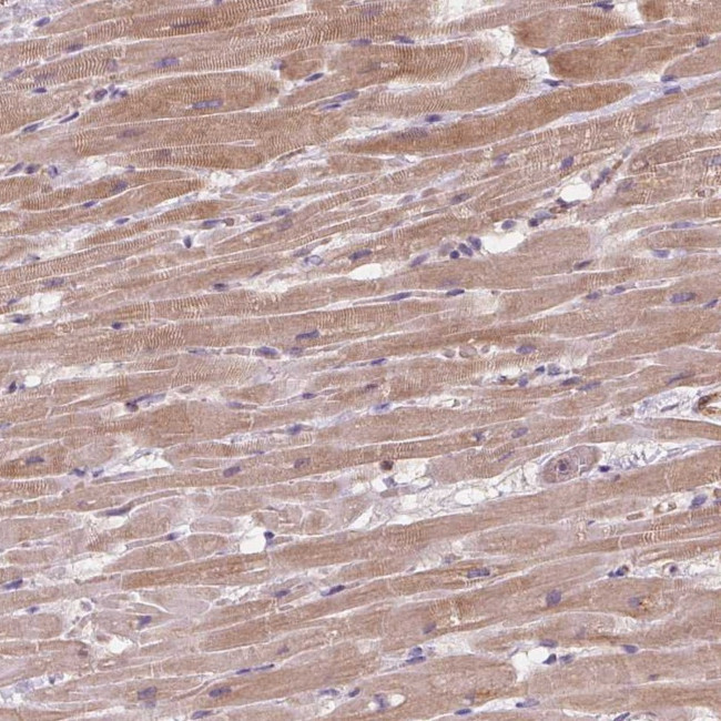 KCNK15 Antibody in Immunohistochemistry (Paraffin) (IHC (P))