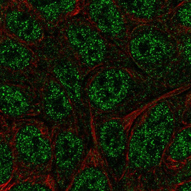BATF Antibody in Immunocytochemistry (ICC/IF)