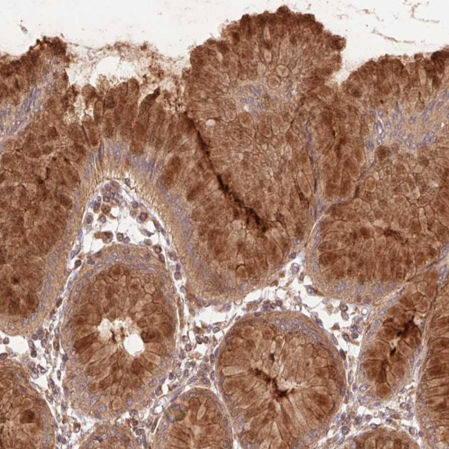 STARD7 Antibody in Immunohistochemistry (Paraffin) (IHC (P))