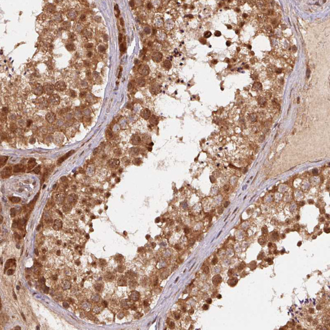 TREML4 Antibody in Immunohistochemistry (Paraffin) (IHC (P))