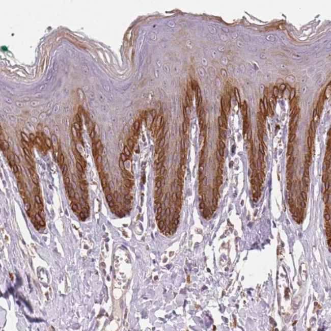 TMEM253 Antibody in Immunohistochemistry (Paraffin) (IHC (P))