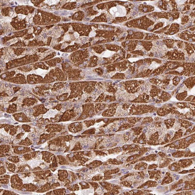 CLASP1 Antibody in Immunohistochemistry (Paraffin) (IHC (P))