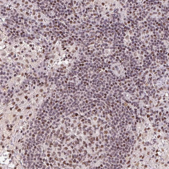 LDLRAD4 Antibody in Immunohistochemistry (Paraffin) (IHC (P))