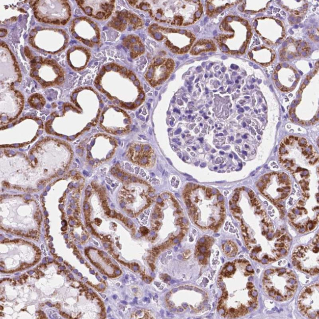 GDPD5 Antibody in Immunohistochemistry (Paraffin) (IHC (P))