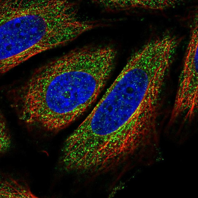 TOCA-1 Antibody in Immunocytochemistry (ICC/IF)