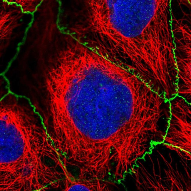 SAMD4A Antibody in Immunocytochemistry (ICC/IF)