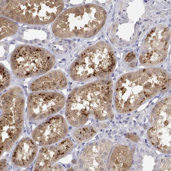 GGACT Antibody in Immunohistochemistry (Paraffin) (IHC (P))