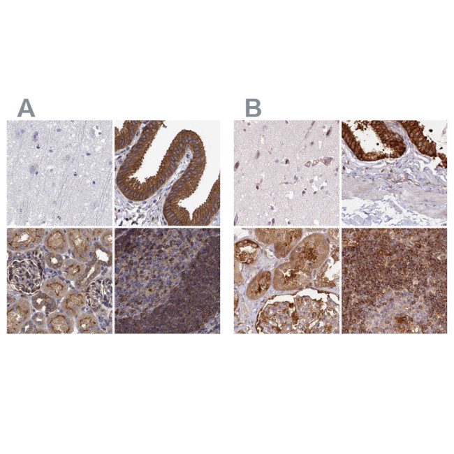 EML4 Antibody in Immunohistochemistry (IHC)