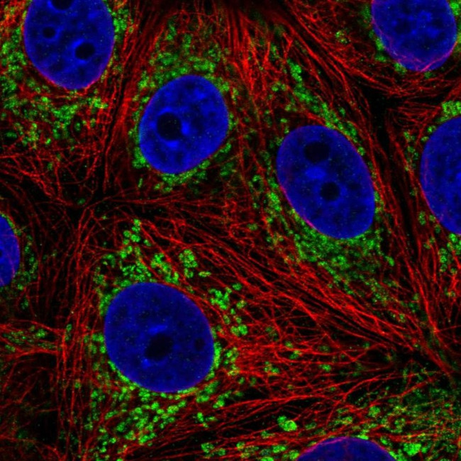 L2HGDH Antibody in Immunocytochemistry (ICC/IF)