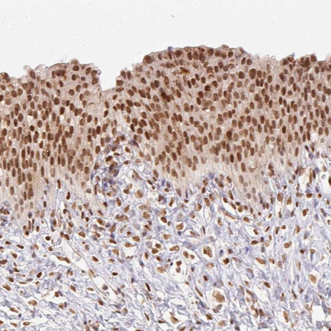 NFE2L1 Antibody in Immunohistochemistry (Paraffin) (IHC (P))