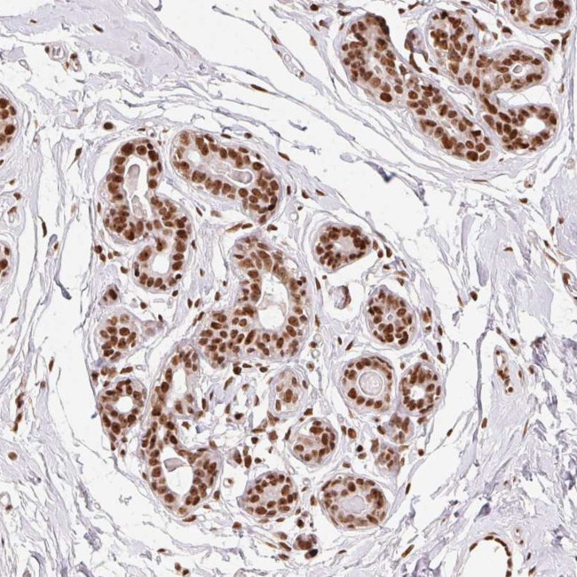 ZNF80 Antibody in Immunohistochemistry (Paraffin) (IHC (P))