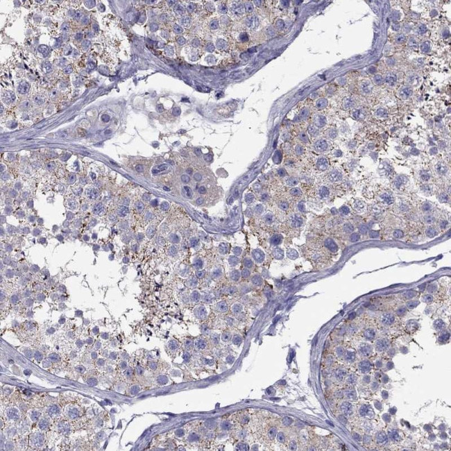 TEX22 Antibody in Immunohistochemistry (IHC)