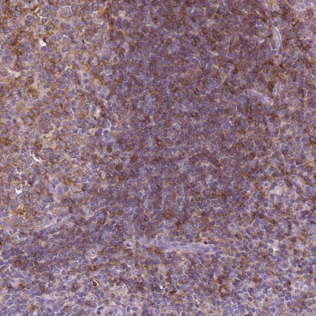MKRN2OS Antibody in Immunohistochemistry (Paraffin) (IHC (P))
