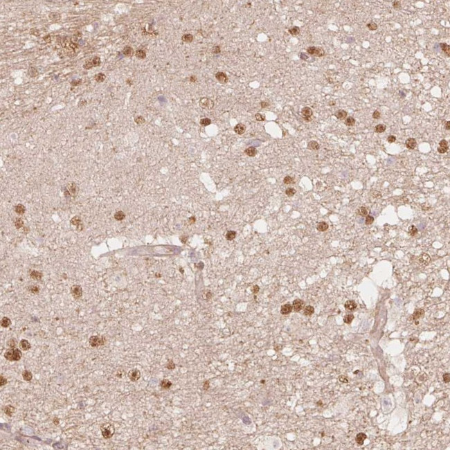 QDPR Antibody in Immunohistochemistry (Paraffin) (IHC (P))