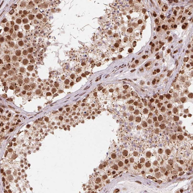 TOPORS Antibody in Immunohistochemistry (Paraffin) (IHC (P))