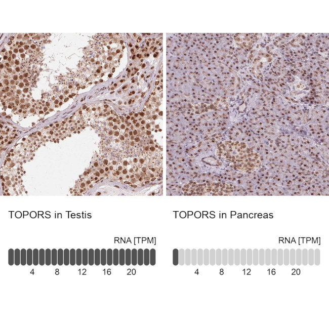 TOPORS Antibody in Immunohistochemistry (IHC)
