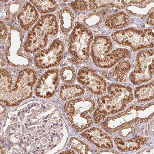 WBP2 Antibody in Immunohistochemistry (Paraffin) (IHC (P))