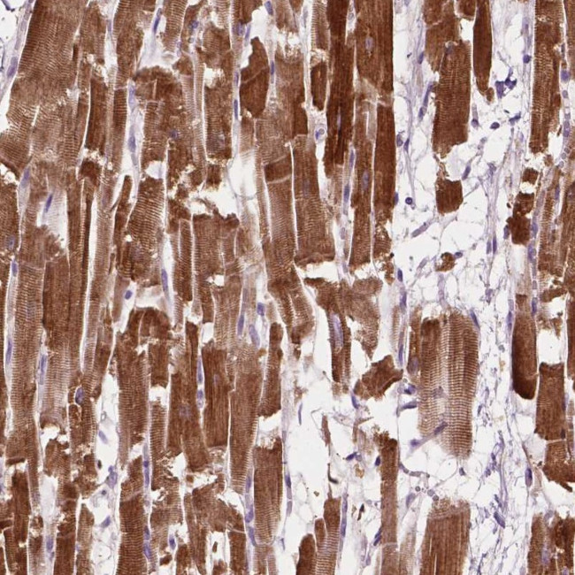 LRR1 Antibody in Immunohistochemistry (Paraffin) (IHC (P))