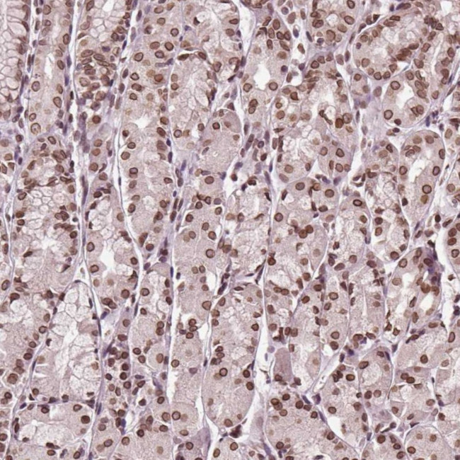 TTC39C Antibody in Immunohistochemistry (Paraffin) (IHC (P))