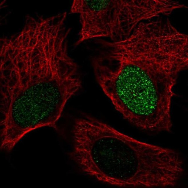 SMIM6 Antibody in Immunocytochemistry (ICC/IF)
