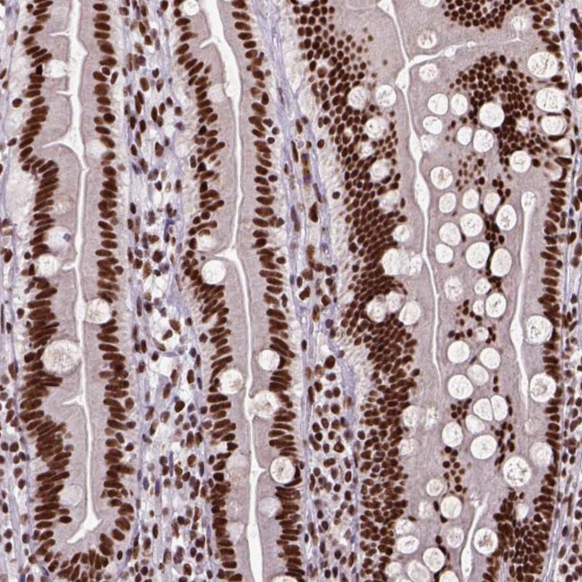 NSE2 Antibody in Immunohistochemistry (Paraffin) (IHC (P))