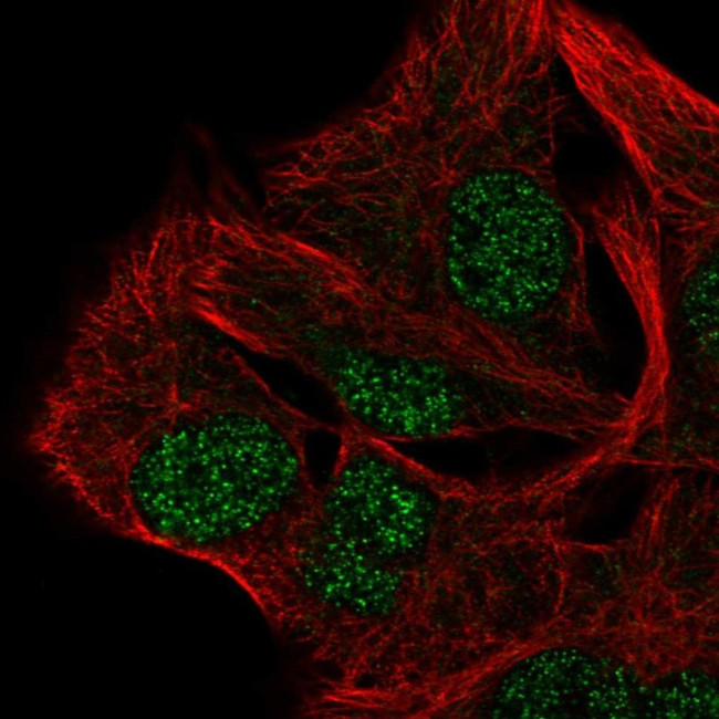 AP5B1 Antibody in Immunocytochemistry (ICC/IF)