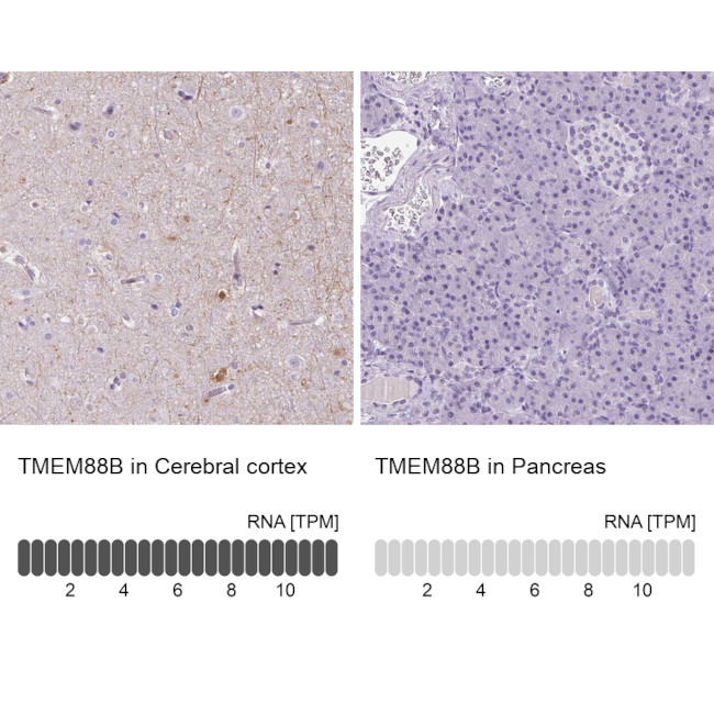 TMEM88B Antibody in Immunohistochemistry (IHC)