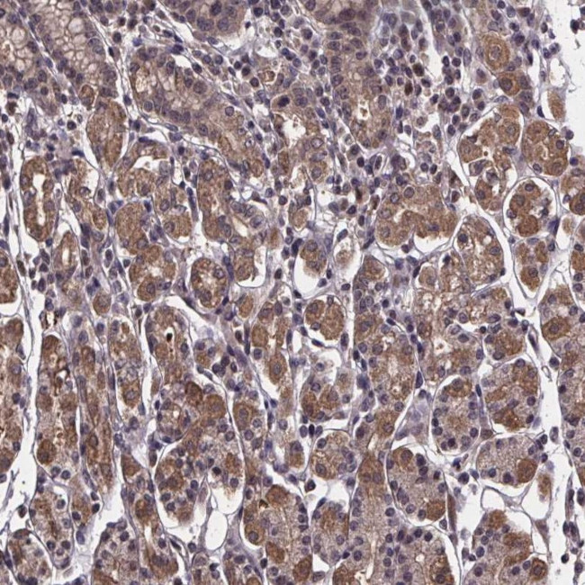 FN3KRP Antibody in Immunohistochemistry (Paraffin) (IHC (P))