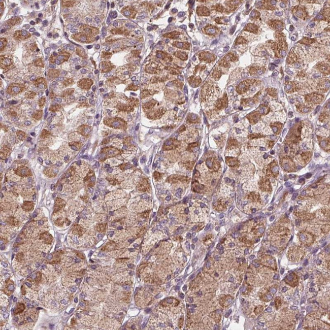 ORAI2 Antibody in Immunohistochemistry (Paraffin) (IHC (P))