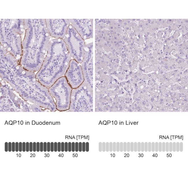 Aquaporin 10 Antibody