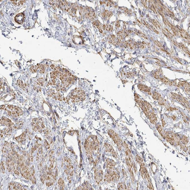 ANKRD58 Antibody in Immunohistochemistry (Paraffin) (IHC (P))