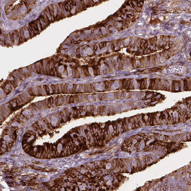 TM6SF2 Antibody in Immunohistochemistry (Paraffin) (IHC (P))
