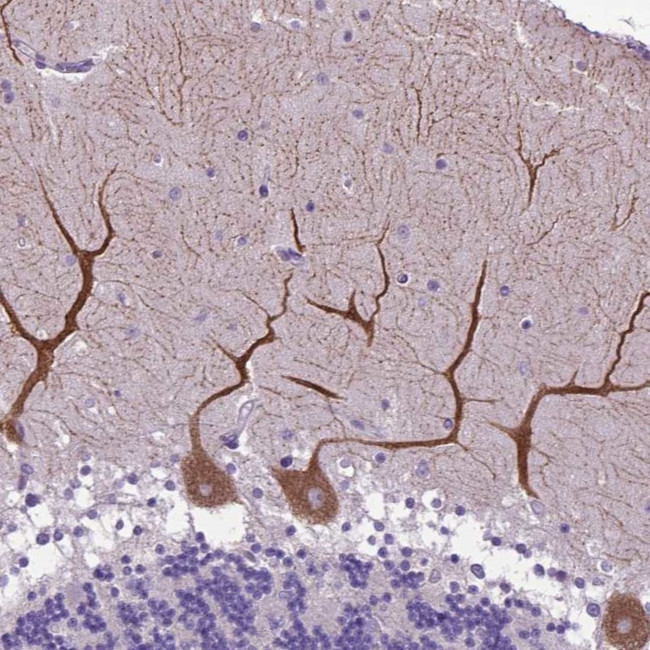 alpha-2b Adrenergic Receptor Antibody in Immunohistochemistry (Paraffin) (IHC (P))