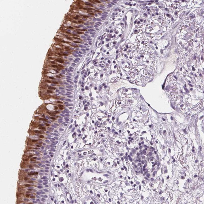 DBX2 Antibody in Immunohistochemistry (Paraffin) (IHC (P))