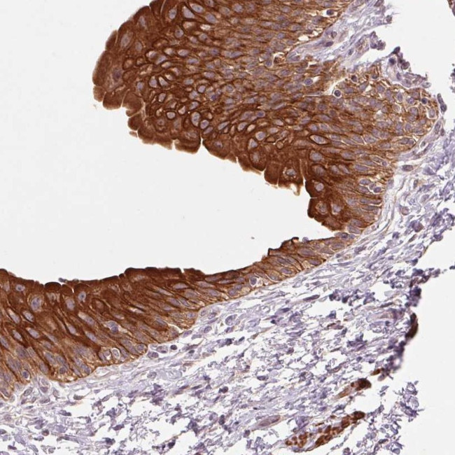 SMLR1 Antibody in Immunohistochemistry (Paraffin) (IHC (P))