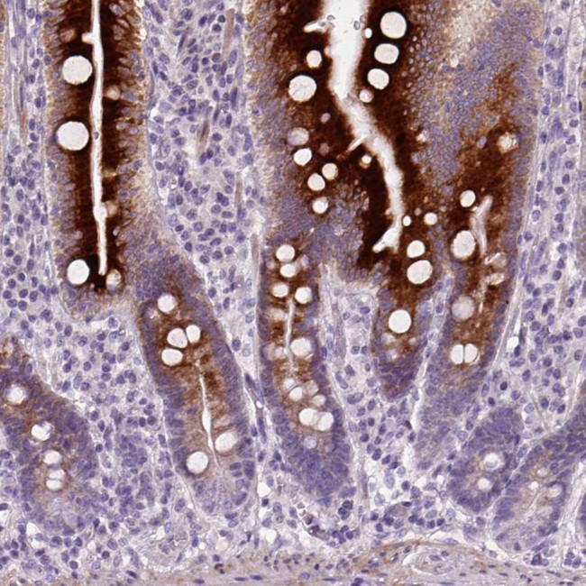 NUDT6 Antibody in Immunohistochemistry (Paraffin) (IHC (P))