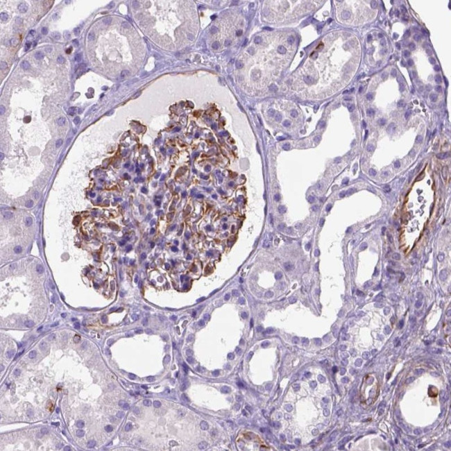 ZZZ3 Antibody in Immunohistochemistry (Paraffin) (IHC (P))