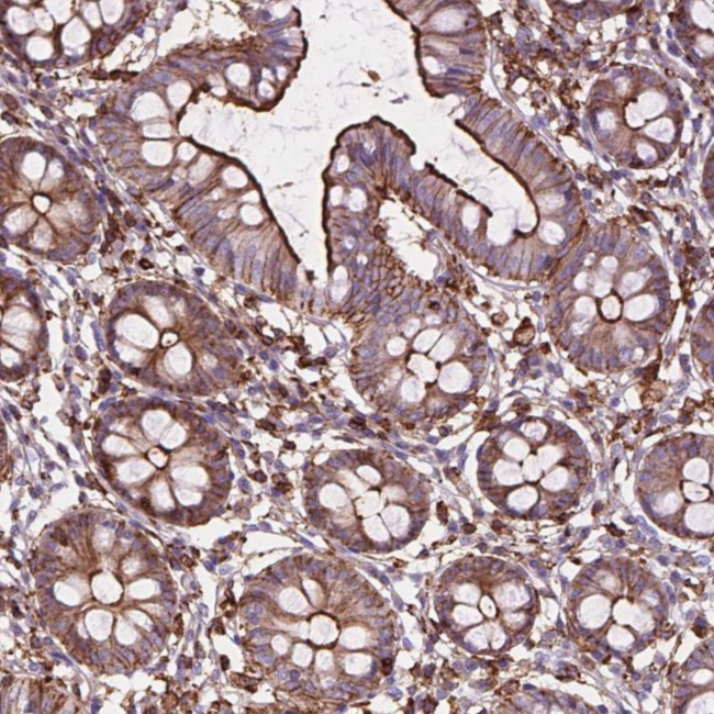 PATJ Antibody in Immunohistochemistry (Paraffin) (IHC (P))