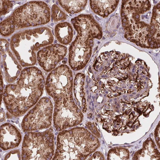 GOLT1B Antibody in Immunohistochemistry (Paraffin) (IHC (P))