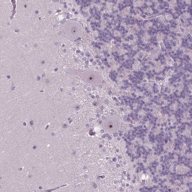 SMIM18 Antibody in Immunohistochemistry (Paraffin) (IHC (P))