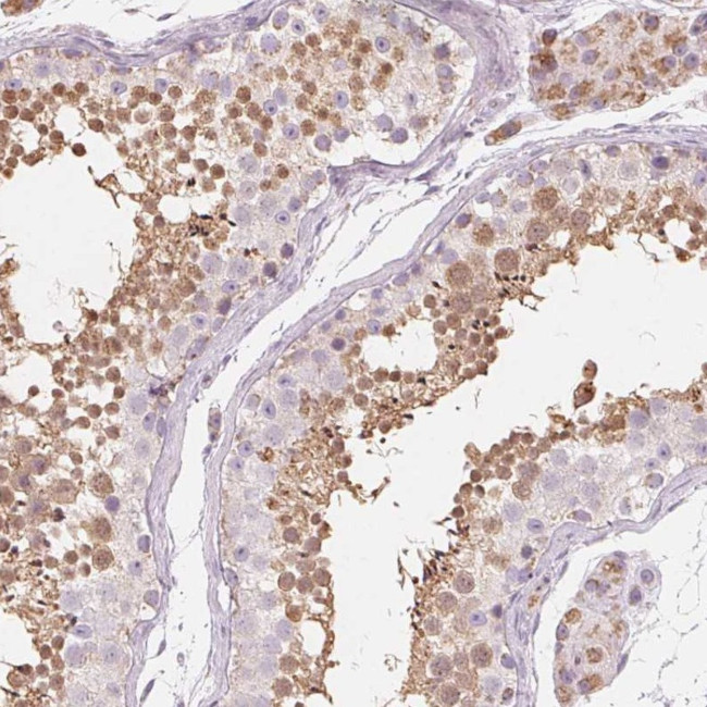 NUP210L Antibody in Immunohistochemistry (Paraffin) (IHC (P))