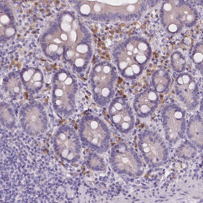 CD96 Antibody in Immunohistochemistry (IHC)