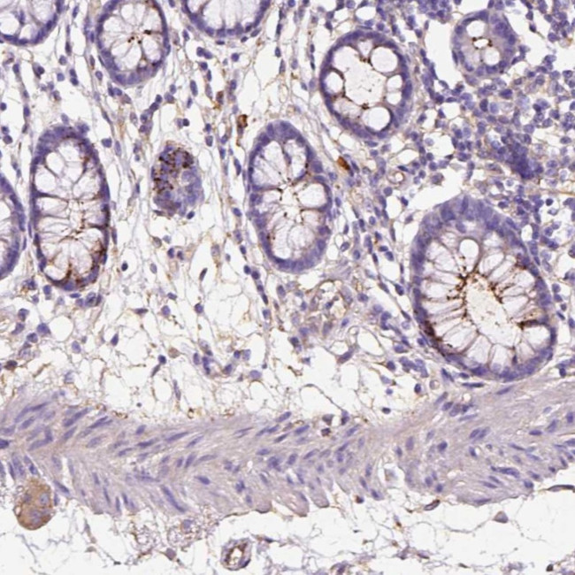 GDPD5 Antibody in Immunohistochemistry (Paraffin) (IHC (P))