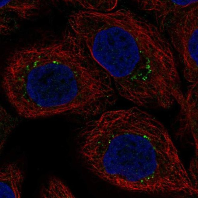 AP1S3 Antibody in Immunocytochemistry (ICC/IF)