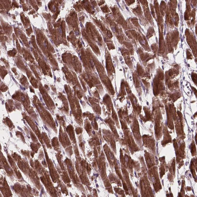 MRPL33 Antibody in Immunohistochemistry (Paraffin) (IHC (P))