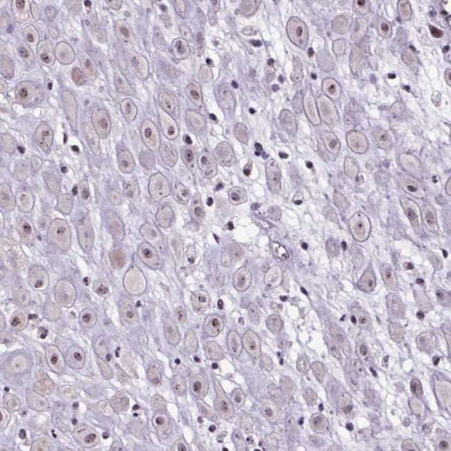 ATMIN Antibody in Immunohistochemistry (Paraffin) (IHC (P))