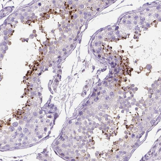 TMEM210 Antibody in Immunohistochemistry (Paraffin) (IHC (P))